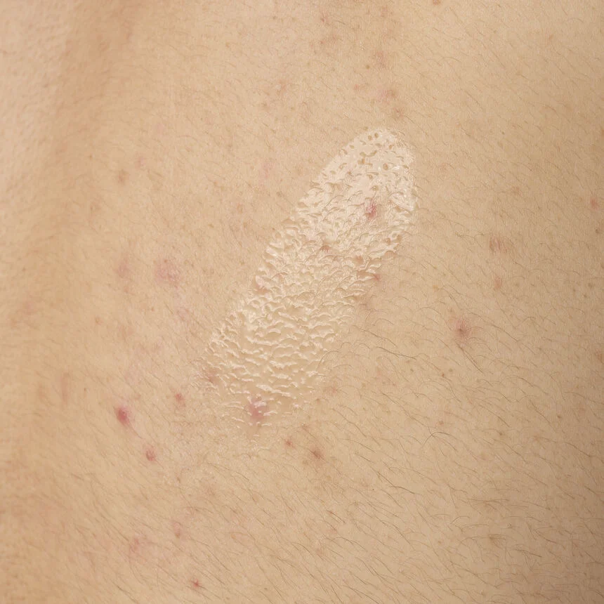 ORD-salicylic-acid-05-body-240ml-application.webp The Ordinary Salicylic Acid 0.5% Body Serum - Image 3