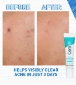Cerave Acne Control Gel - Image 3