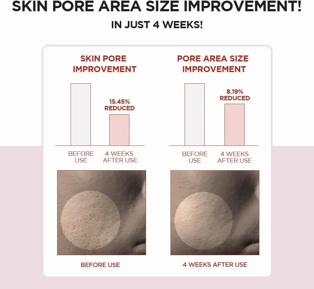 51sixRqGJwL._AC_SL1000_ SKIN1004 Madagascar Centella Poremizing Clear Toner - Image 6