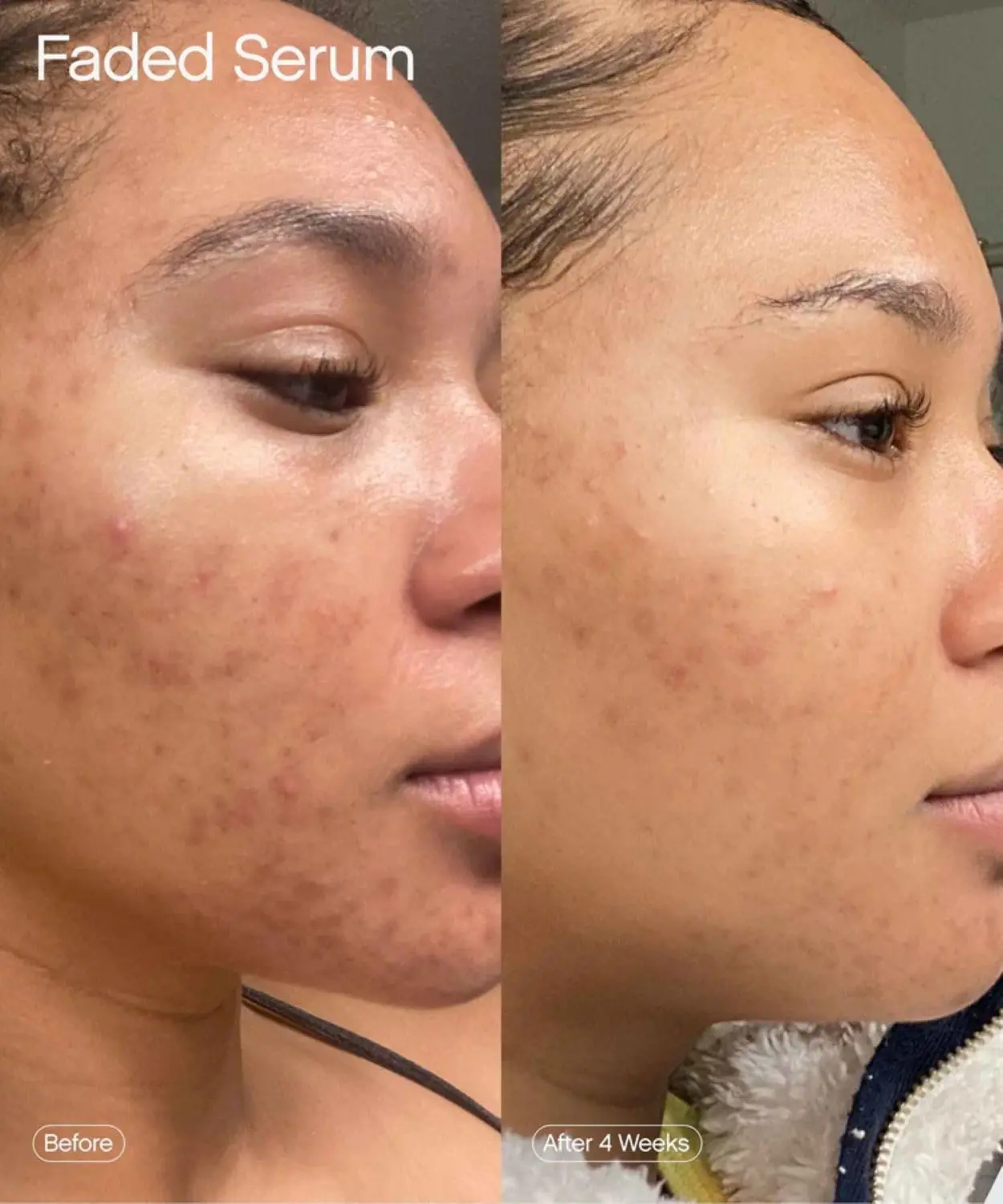 71gir9YPhAL._SL1500_ Topicals Faded Brightening & Clearing Serum - Image 4