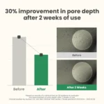 AXIS-Y LHA Peel & Fill Pore Balancing Cream - Image 4