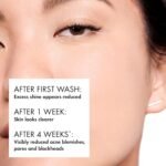 Vichy Normaderm PhytoAction Salicylic Acid Gel Cleanser - Image 2