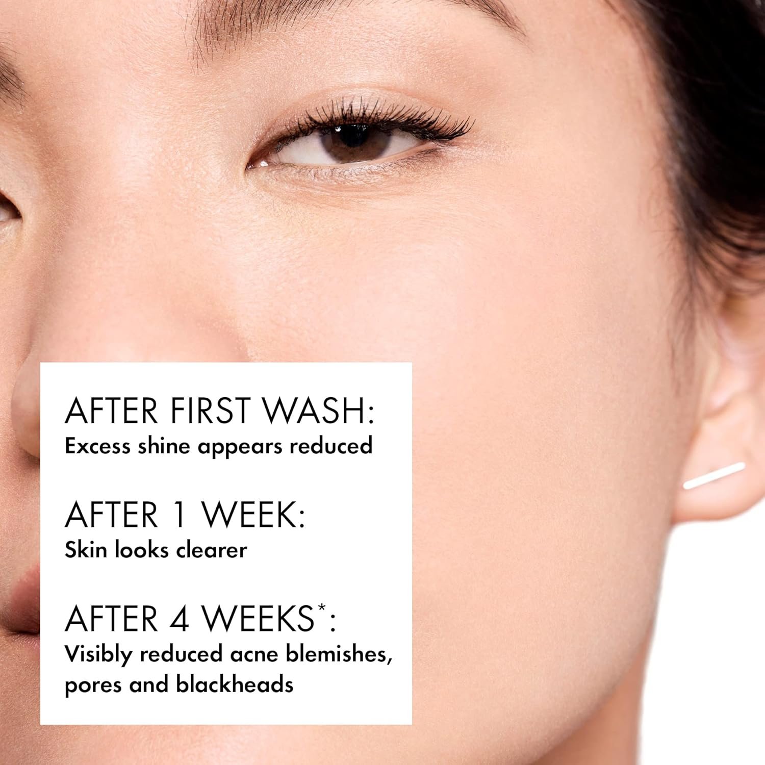 71SUztUQQWL._SL1500_ Vichy Normaderm PhytoAction Salicylic Acid Gel Cleanser - Image 2