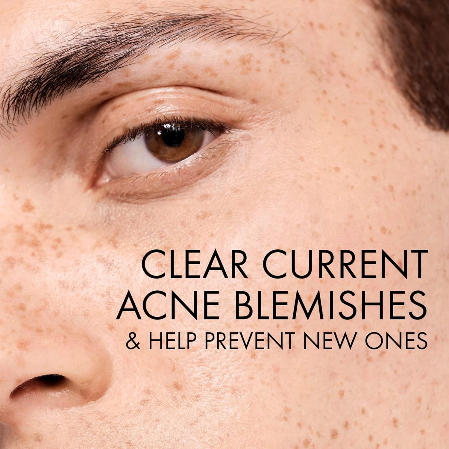 81xPZo7IAML._SL1500_ Vichy Normaderm PhytoAction Salicylic Acid Gel Cleanser - Image 4