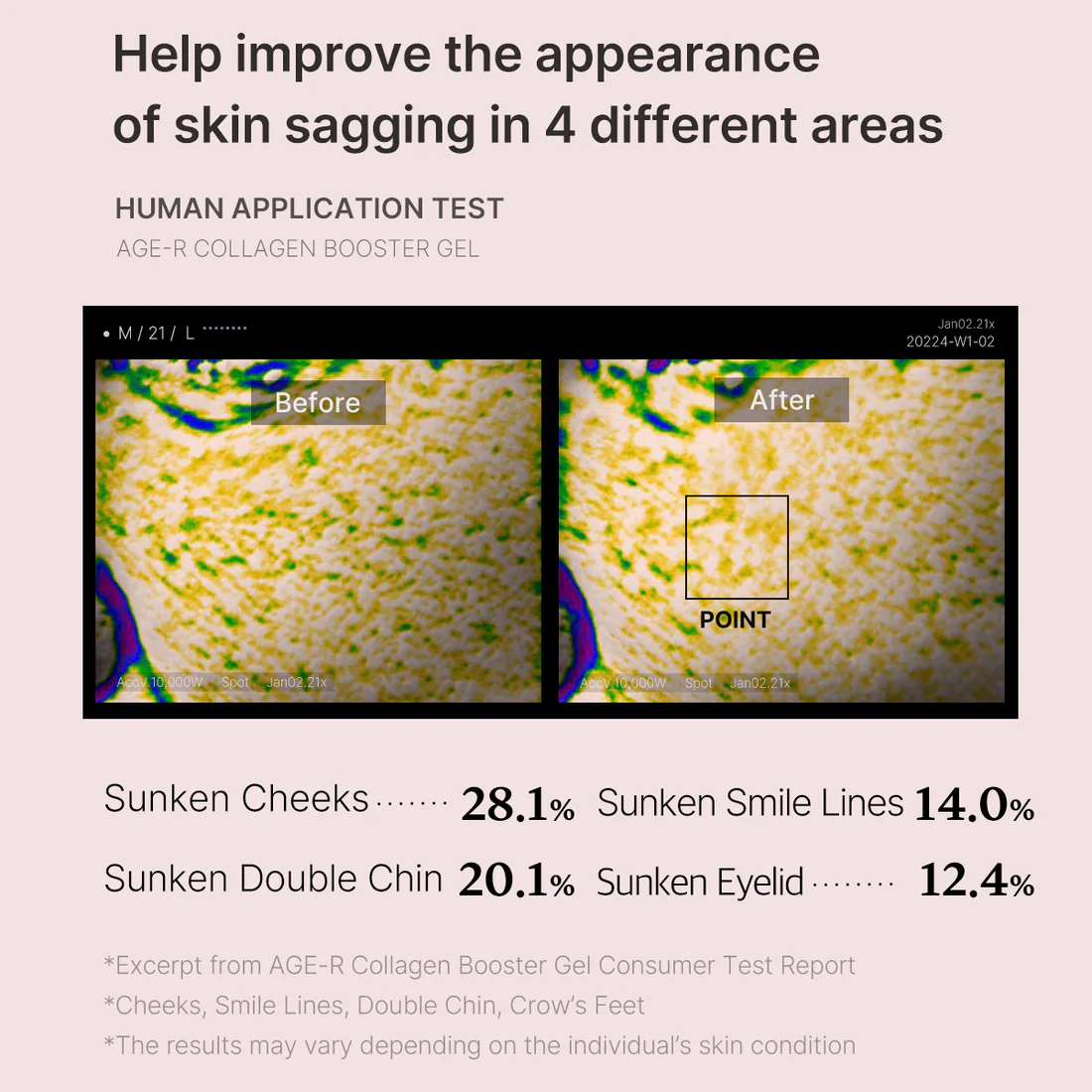 6_159958b4-850c-44f2-90ad-84ea1f9c2b6b Medicube Age-R Collagen Booster Gel - Image 5